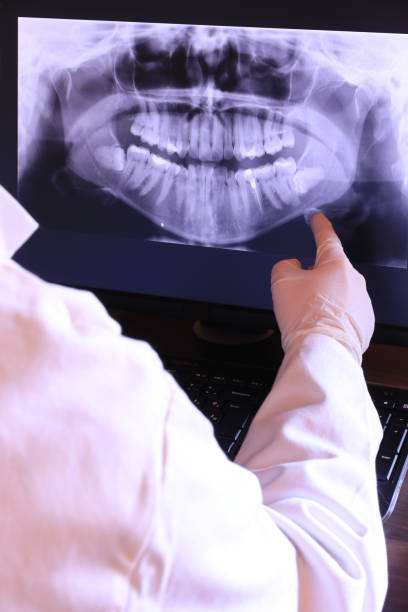 Best Broken or Cracked Tooth Emergency Dentist in West Mountain, UT