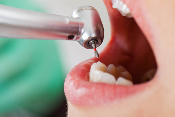 Best Emergency Dentist for Special Needs Patients in West Mountain, UT